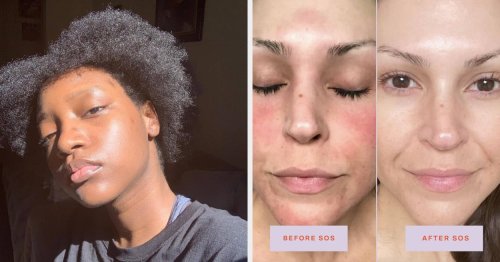 If Your Skin Is Absolutely Parched Right Now, You’ll Want To Check Out These 27 Products
