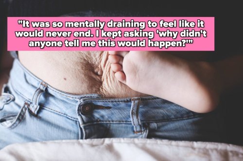 Women Are Sharing The Side Effects Of Pregnancy And Childbirth That People Don't Talk About Enough