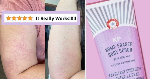 33 Bestselling Beauty Products With Before And After Shots That Will Finally Convince You To Buy Them