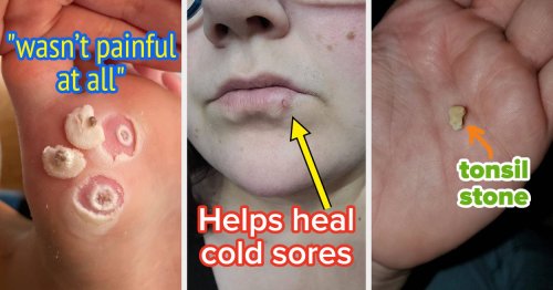 32 Personal Care Products To Help You With Those Little Problems You Wish Didn't Exist