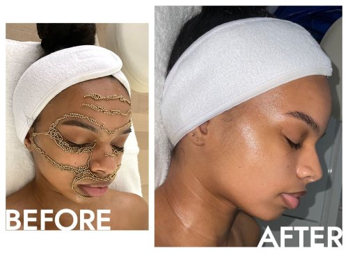 This Facial Uses 24K Gold Magnets to Sculpt and Repair Your Skin–And I Tried It