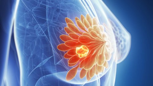 Oktober ist Brustkrebsmonat –Therapieerfolge, Prävention und Früherkennung