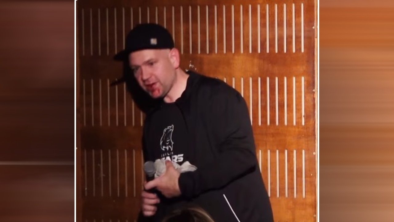 Gar nicht lustig! Berliner Comedian auf Bühne blutig geschlagen