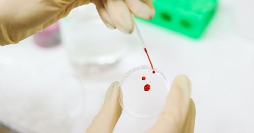 Ce test sanguin peut détecter plus de 50 types de cancer
