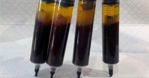 Cette étrange photo de "prélèvements sanguins de personnes vaccinées" inquiète