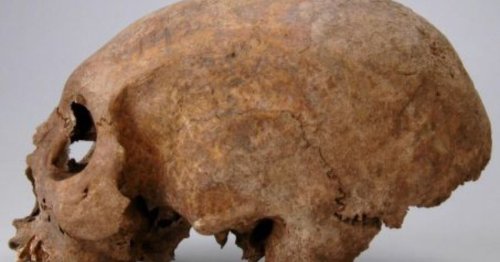 Vikings : des chercheurs ont découvert une élongation crânienne inédite chez trois femmes