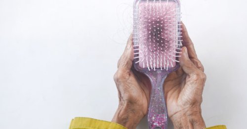Quelles sont les causes de l'alopécie ?