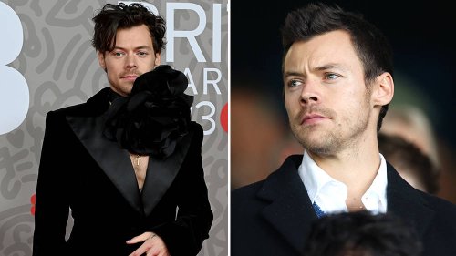 Why Harry Styles being bald feels like a fever dream