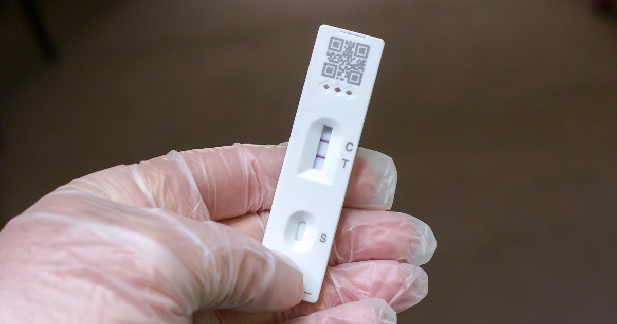 Do COVID-19 tests still work after they expire? Here's how to tell.