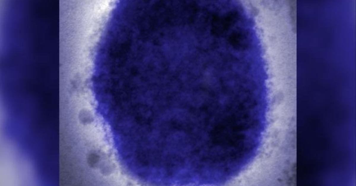Video: What is monkeypox?