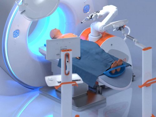 Cancers : ce robot chirurgical "Made in Montpellier" perce aux Etats-Unis