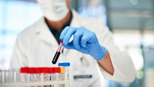 Kleines vs. großes Blutbild: Die Unterschiede im Check