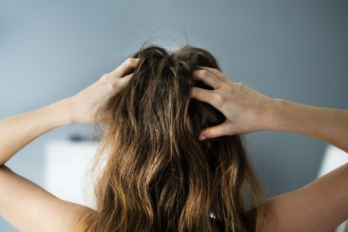 Kopfhaut pflegen: Zwei Hausmittel gegen Schuppen kommen aus der Küche