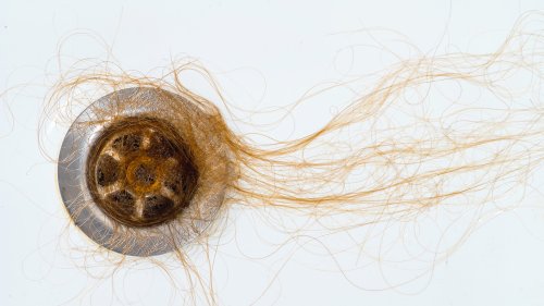 Nicht nur genetisch: Welche Krankheiten hinter Haarausfall stecken können