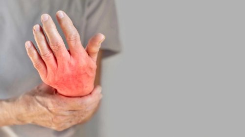 Diese Nahrungsmittel können Rheuma fördern: So vermeiden Sie Entzündungen
