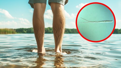Bade-Parasiten: Diese Würmer bohren sich durch die Haut