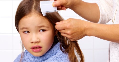 NHS releases headlice treatment advice as children go back to school