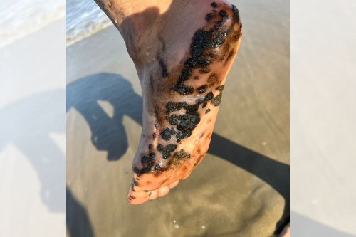 PICS: Oil pellets wash up on Mossel Bay beaches, forcing closures