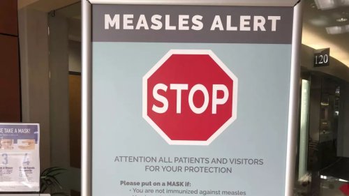 AHS issues warning for potential measles exposure at 3 Edmonton area medical clinics