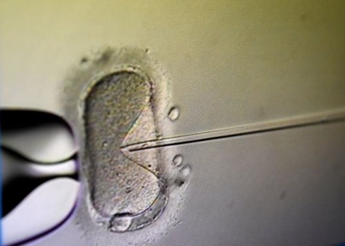 Ohio abortion bill could criminalize IVF, doctor says: The Wake Up for Friday, May 27, 2022