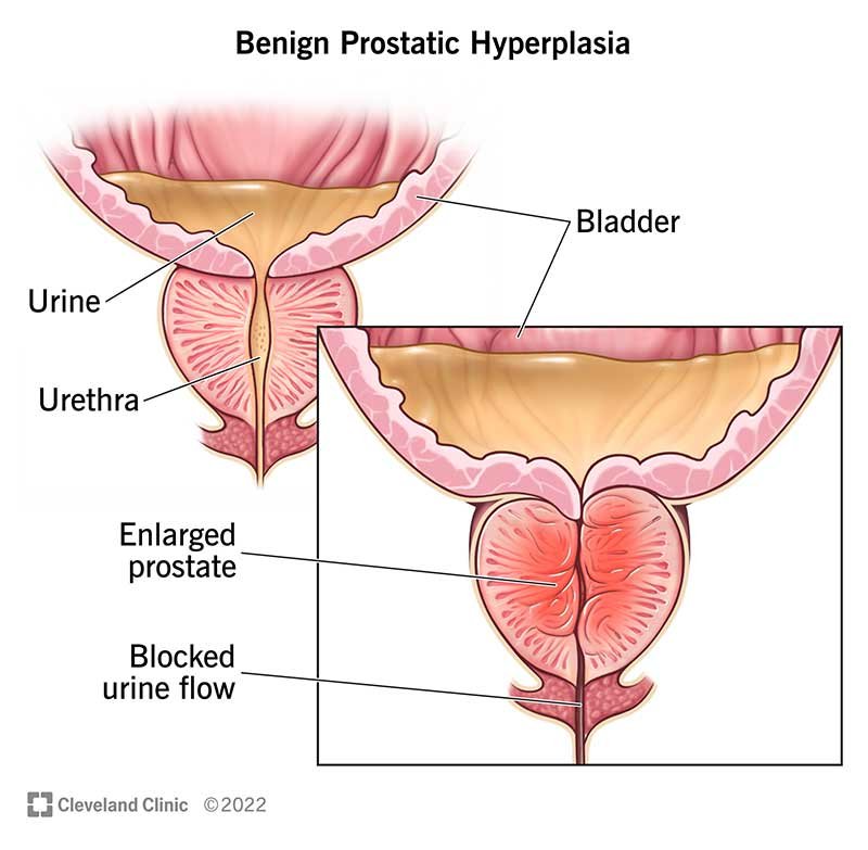 Prostate Health cover image
