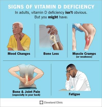 Vitamin D Deficiency: Causes, Symptoms & Treatment