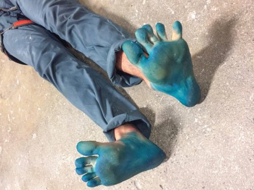 Re-Gram: 9 Photos of Heinous Climber Feet