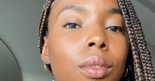 I Tried This New $17 Product and It Completely Faded My Dark Spots