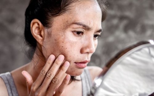 6 Unusual Habits Derms Swear By To Make Age Spots And Hyperpigmentation Vanish