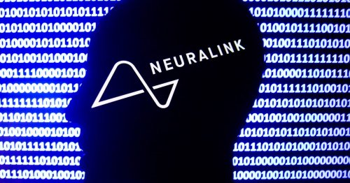 Watch Live: Neuralink Brain Implant 'Show and Tell' Update