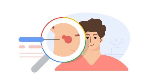 Google will help you identify that suspicious mole or rash