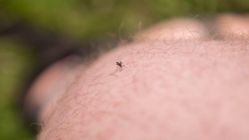 Stop mosquito bite itch with these home remedies