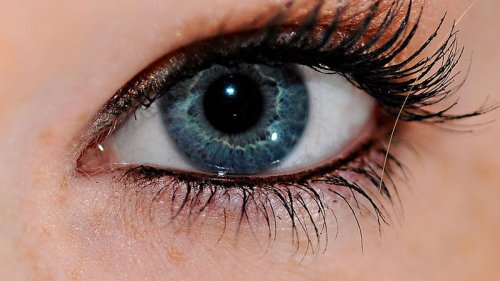Laser treatment claims to turn brown eyes blue
