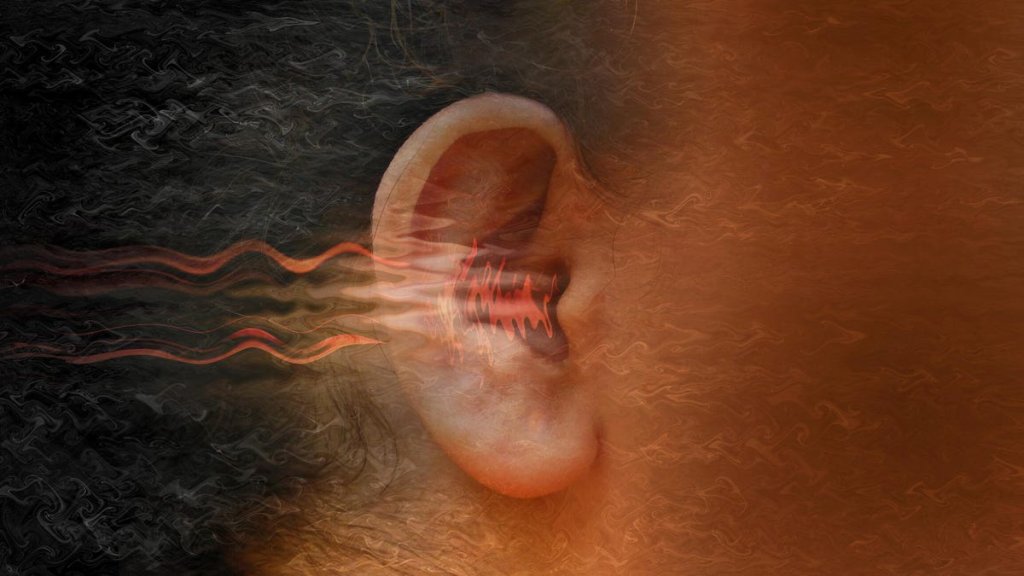 TINNITUS