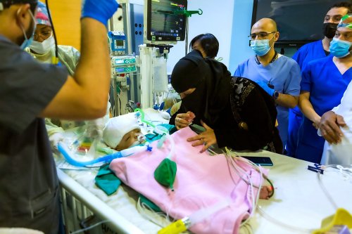 Arabie saoudite : un des jumeaux siamois yéménites séparés lors d’une périlleuse opération est décédé