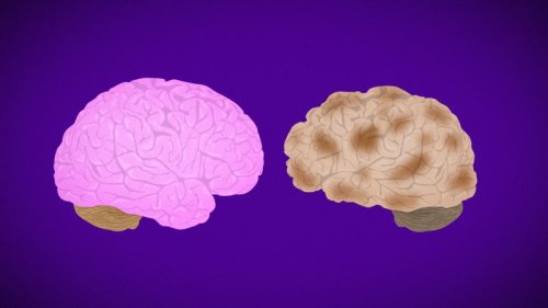 Alzheimer’s Disease Fast Facts