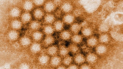 Norovirus cases continue to climb in the US, especially in the Northeast, CDC data shows