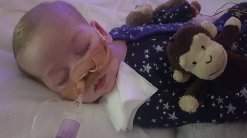 What Charlie Gard case teaches us about life and death