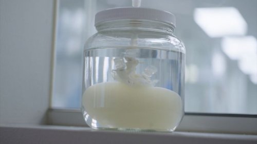 Dr. Sanjay Gupta explains the science behind ‘ghost organs’