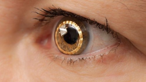 Contact lens with built-in telescope could help people with blinding disease