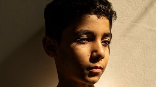 Portrait of a wounded Palestinian boy wins Press Photo of the Year