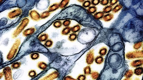 The US hasn’t seen a human bird flu case in 3 months. Experts are wondering why