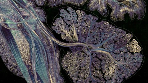 Alles Kopfsache? Die Wellness-Szene hat die neuronale Gesundheit entdeckt