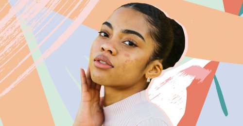 These plant-based supplements have *so* many five-star reviews for 'miraculously clearing' acne in a matter of weeks