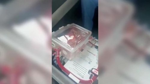 Il «cuore in una scatola» continua a battere: primo trapianto dell’organo vivo al Sant’Orsola di Bologna