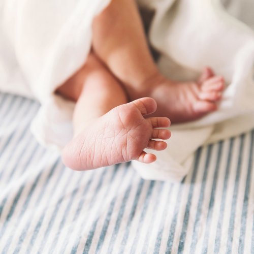 Sensation!: Siamesischer Zwilling bekommt Baby