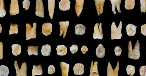 Biologie. Adieu plombages et couronnes ?…. Les dents pourraient un jour pousser en laboratoire
