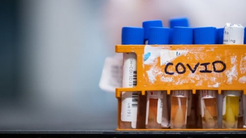 Canada's COVID-19 infections among adults tripled in early 2022 due to Omicron: study
