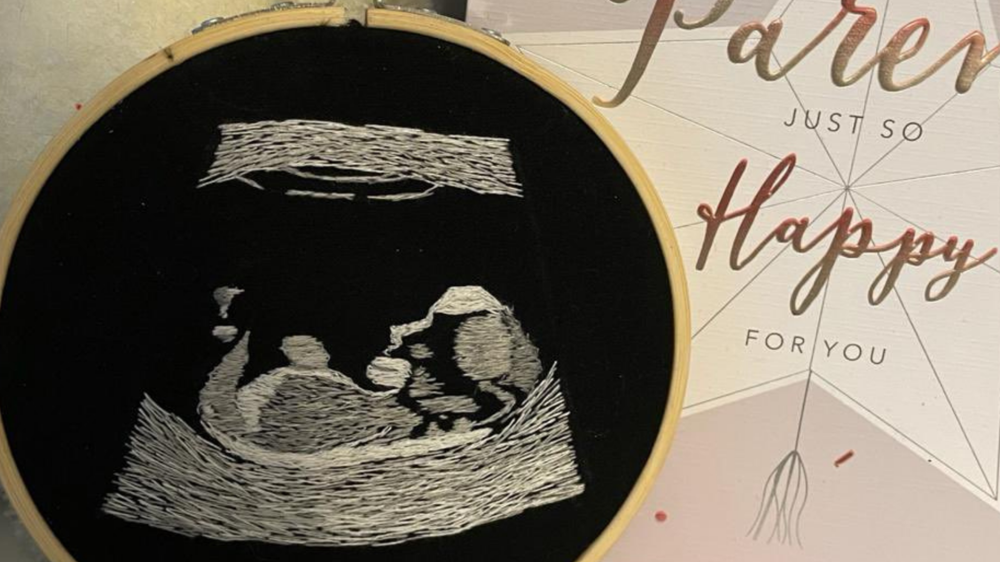 Blind Dad-To-Be Is Surprised With Embroidered Ultrasound So He Can 'See' Unborn Baby