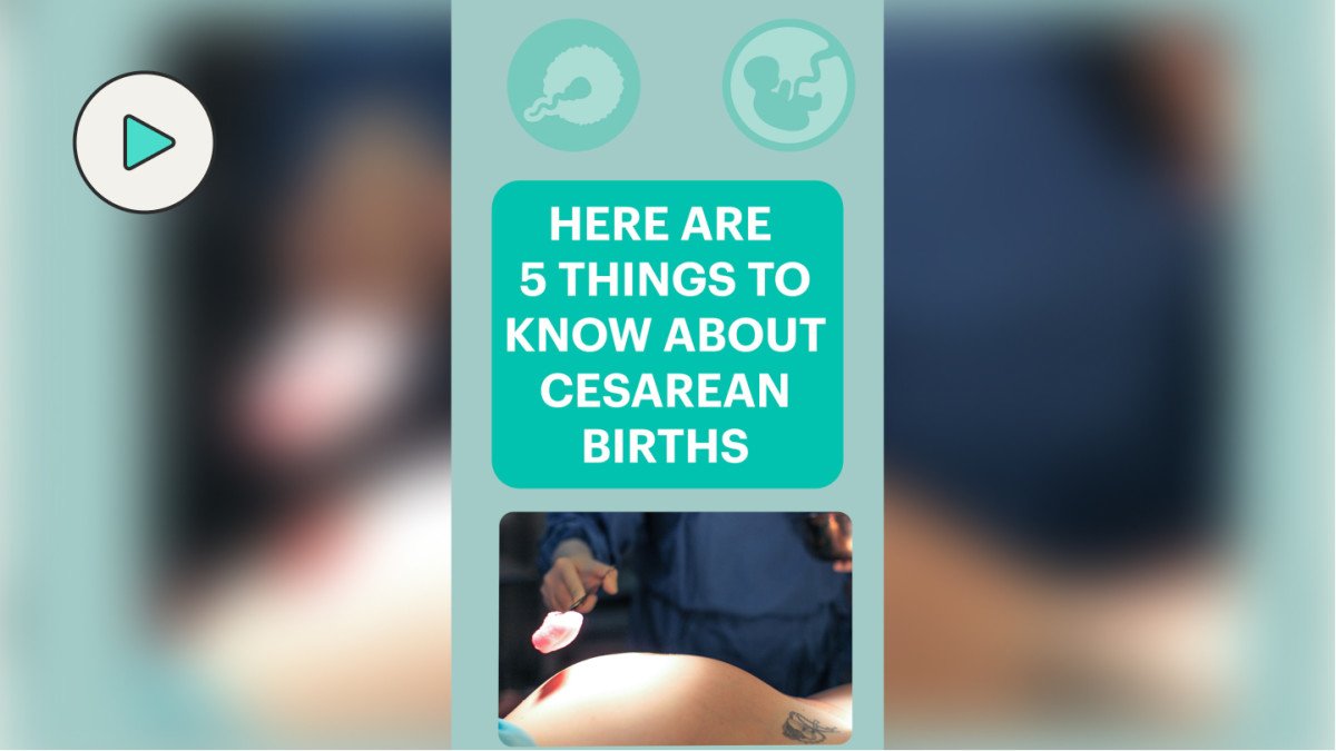 5 Things You Probably Didn't Know About C-Sections